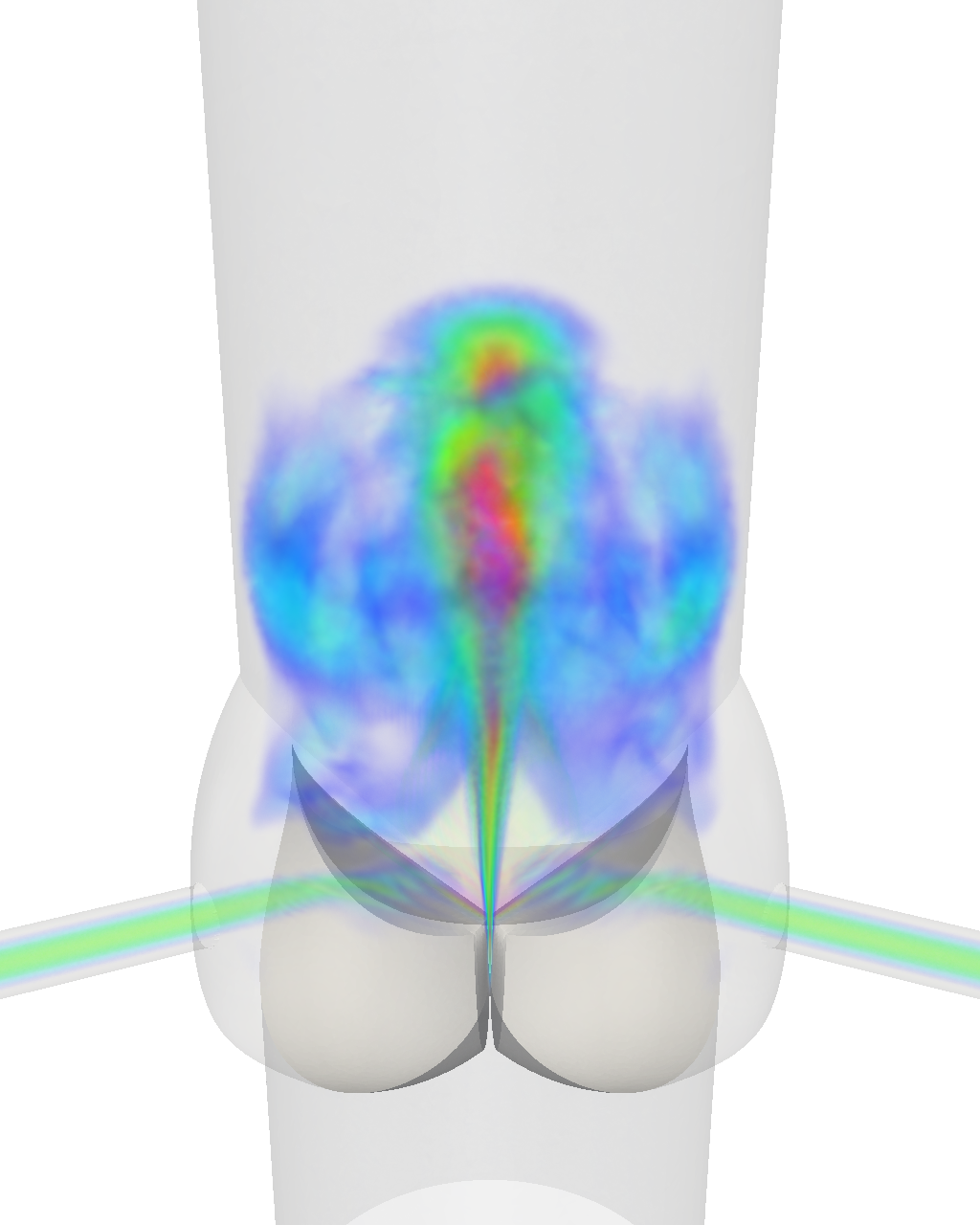 Fluid mechanics computation of heart valve